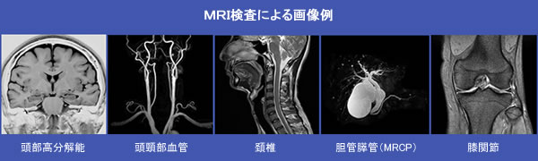 MRI検査の画像2